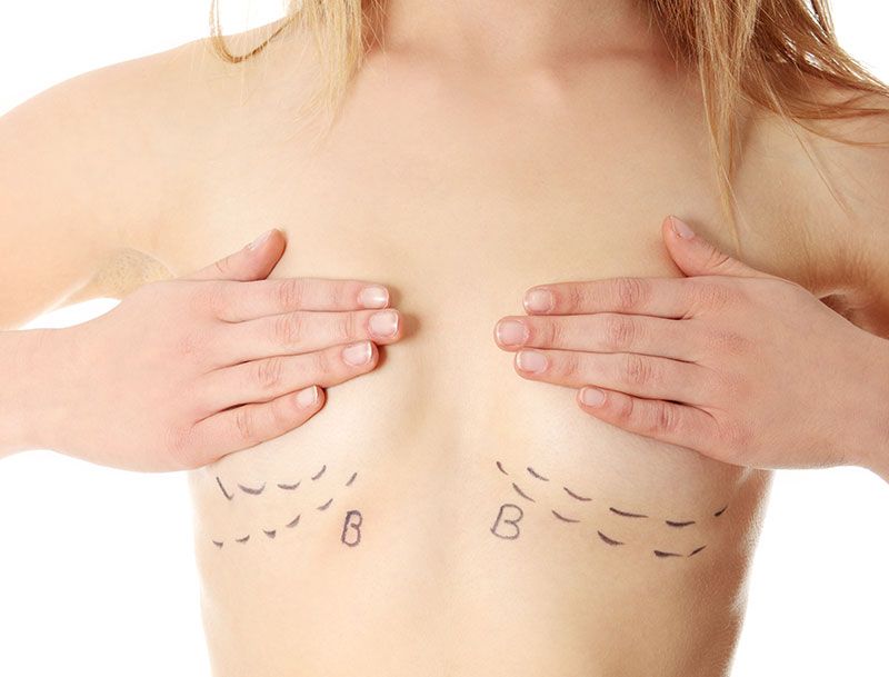 Mini Boob Job Turkey - Mini Breast Augmentation - Dr. Ali Mezdeği